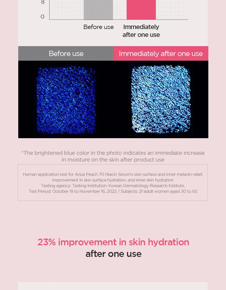 Anua - Peach 70 Niacin Serum 30ml