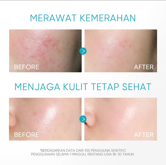 SKINTIFIC PANTHENOL ANTI ACNE FACIAL WASH | 120ml