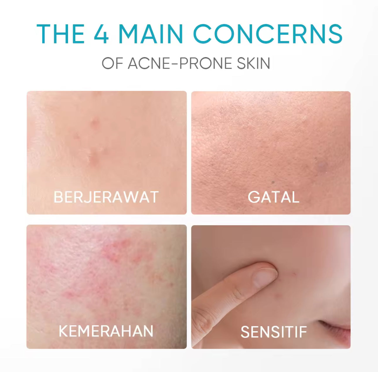 SKINTIFIC 5% PANTHENOL ACNE CALMING WATER GEL (45g)