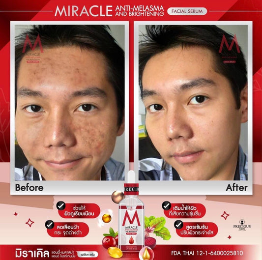 Miracle Anti-Melasma & Brightening Facial Serum | 50ml
