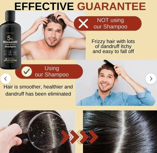 KORMESIC Minoxidil 5% Biotin Hair care | Shampoo| Conditioner | Serum | Massage Cream