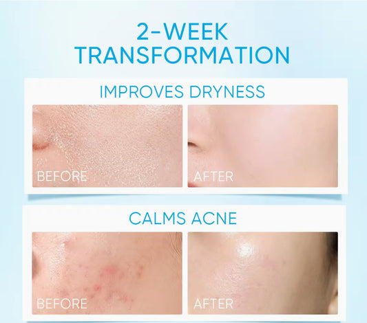 SKINTIFIC 5x Ceramide Barrier Moisture Gel 30g