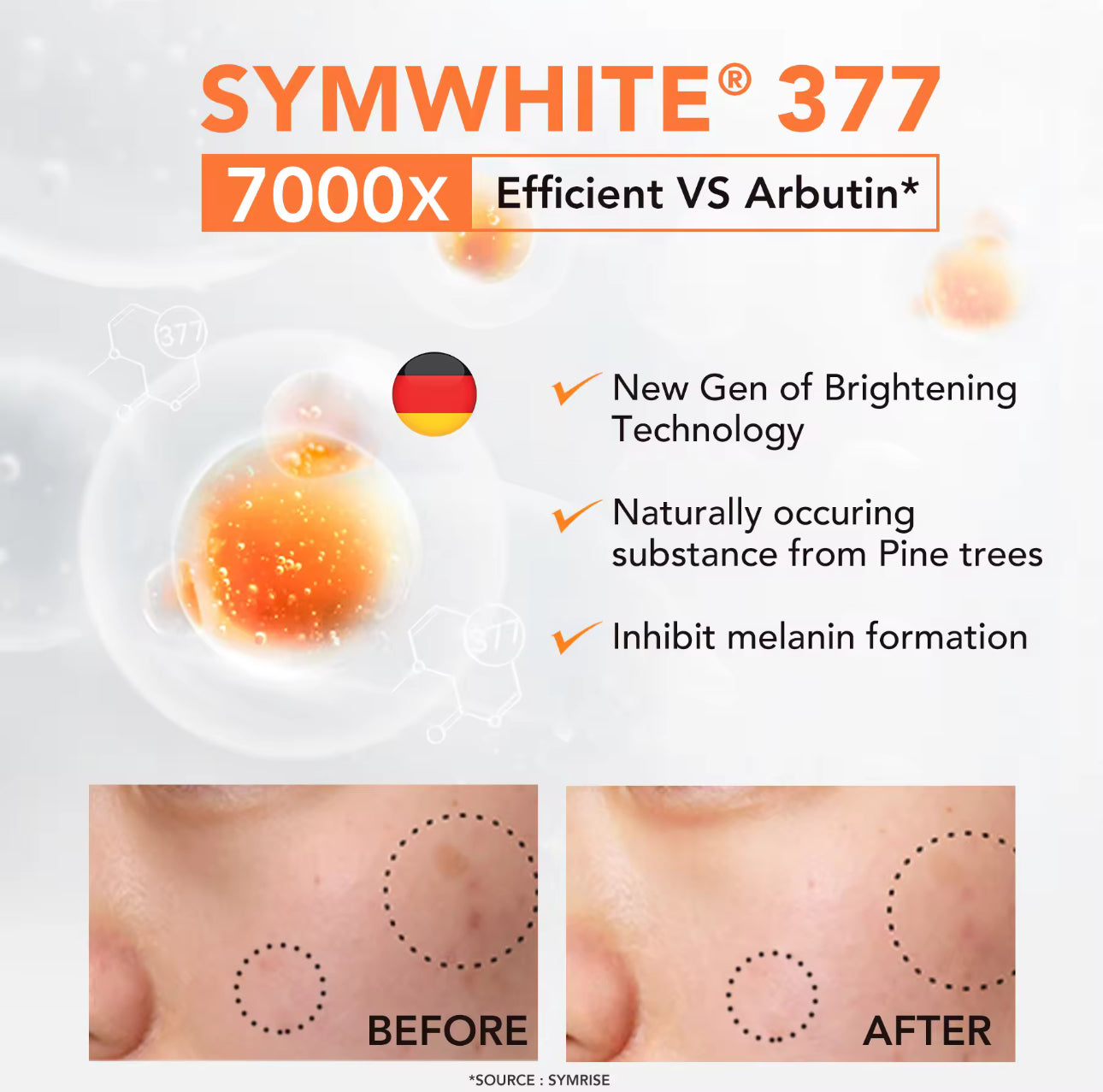 Y.O.U Radiance Up! Antioxidant Serum | 8x Symwhite 377 | Reduce Acne Scars & Dark Spots 20ml