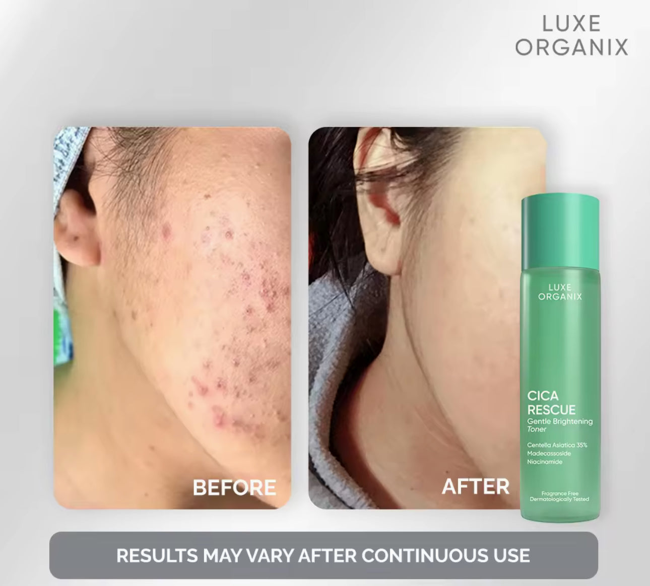 Luxe Organix Cica Rescue Gentle Brightening Toner 150ml