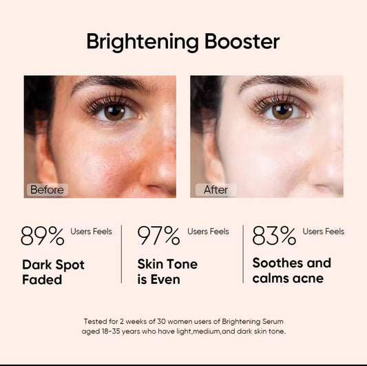 SKINTIFIC Niacinamide Brightening Serum (20ml)