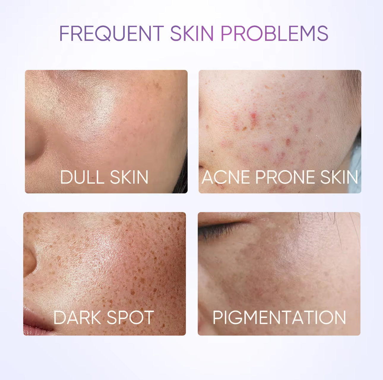 SKINTIFIC OFFICIAL SymWhite 377 Dark Spot Serum With Niacinamide & Tranexamic Acid 50ml