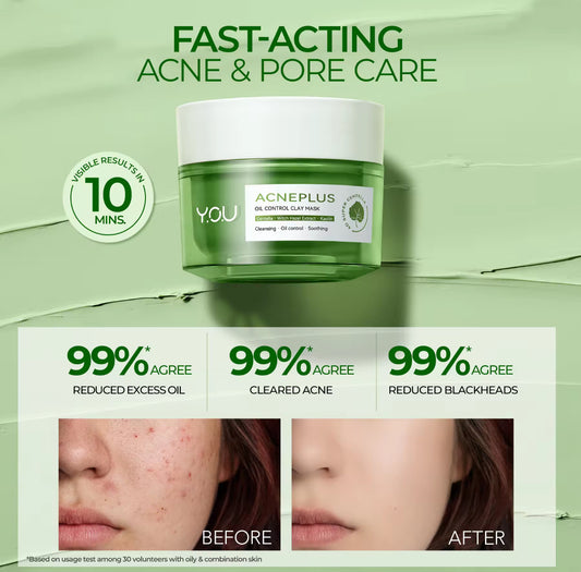 Y.O.U AcnePlus Oil Control Clay Mask | Amazonian Clay | Remove Blackheads & Smoothen Pores 50g