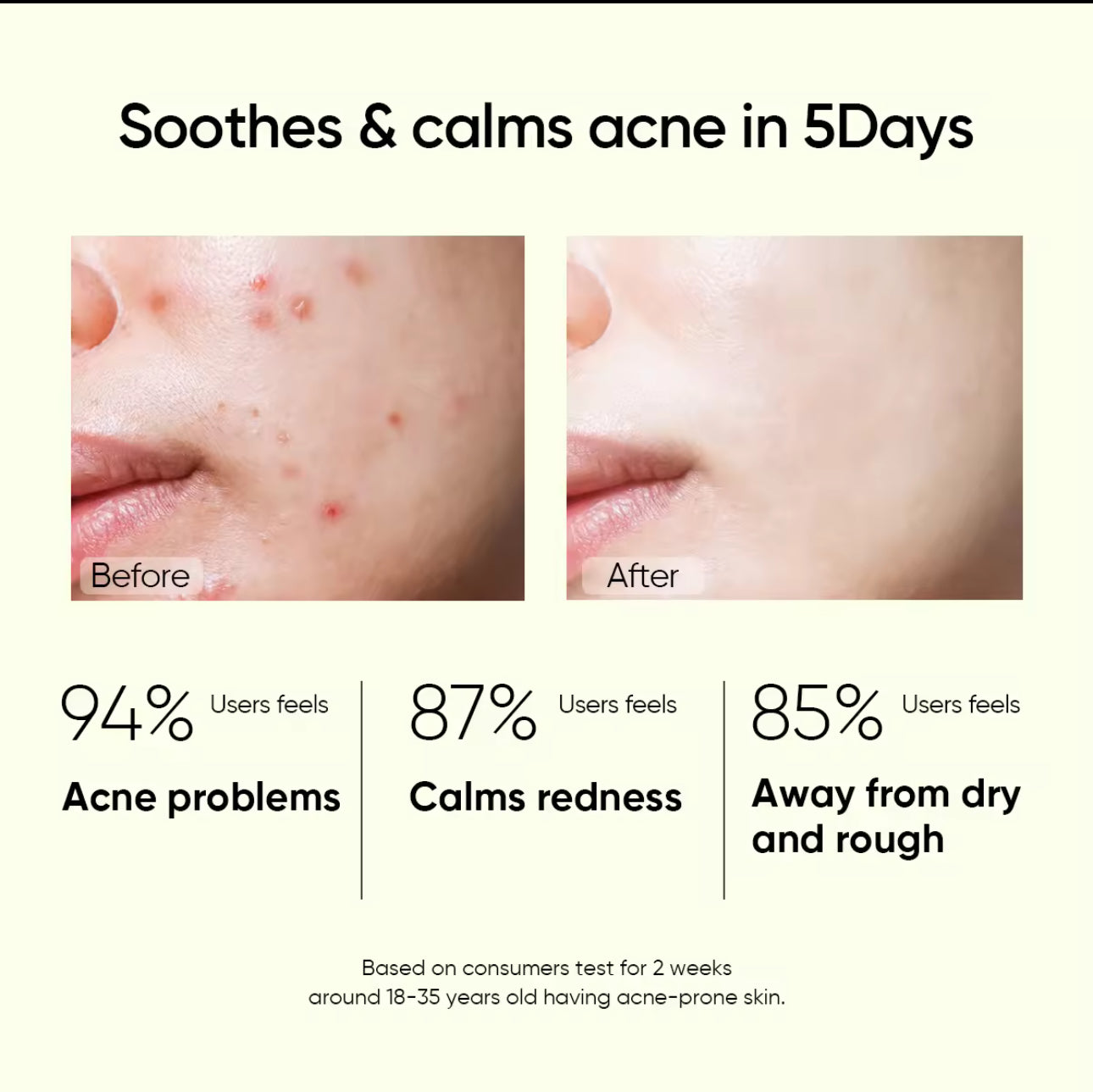 SKINTIFIC Salicylic Acid Anti Acne Serum (20ml)