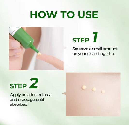 Y.O.U AcnePlus Triple Action Spot Care X | Acne Treatment | Calm Redness | Acne Scar Remover 15g