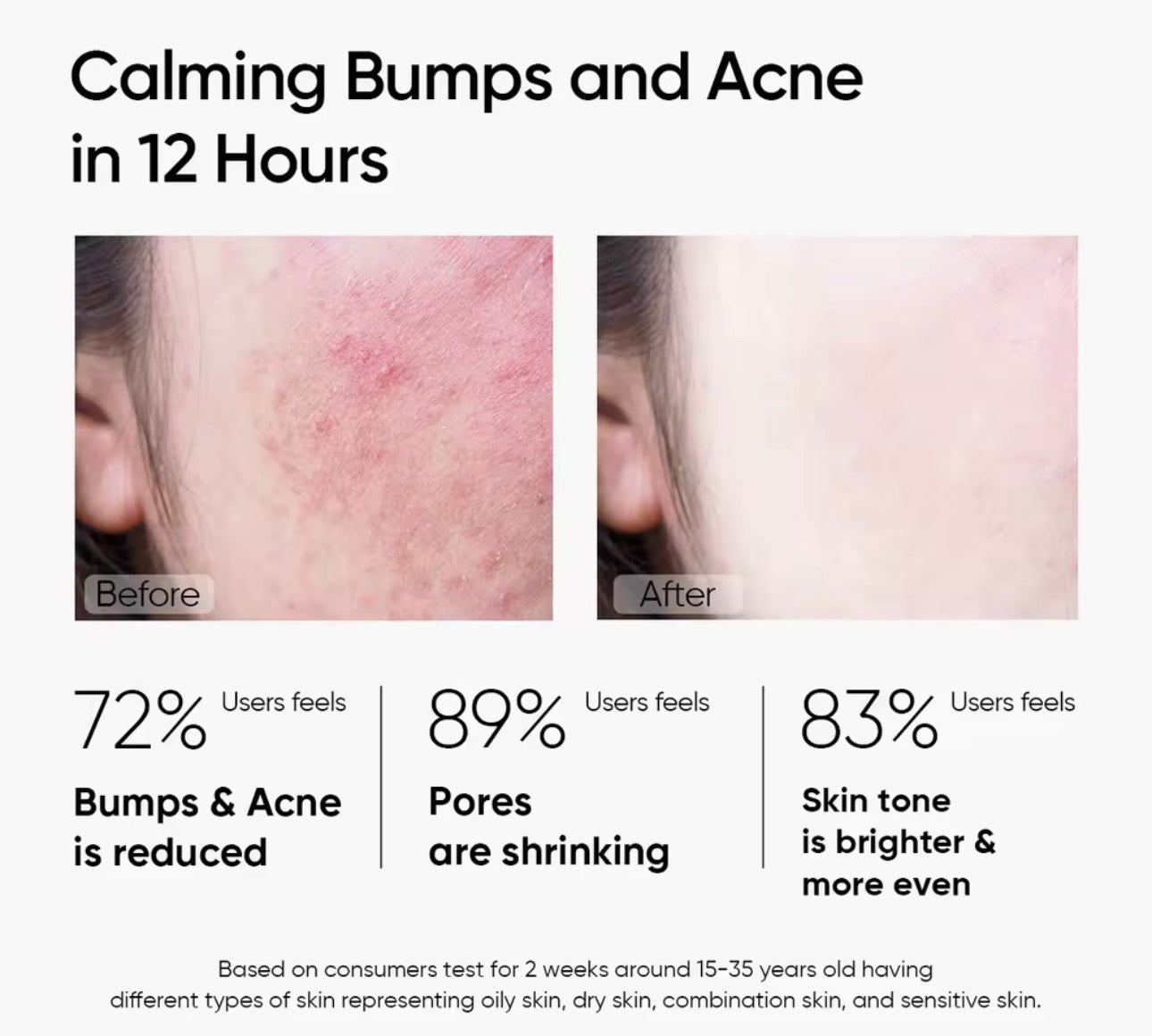 SKINTIFIC Mugwort Anti-Pores & Acne Clay Mask |55g