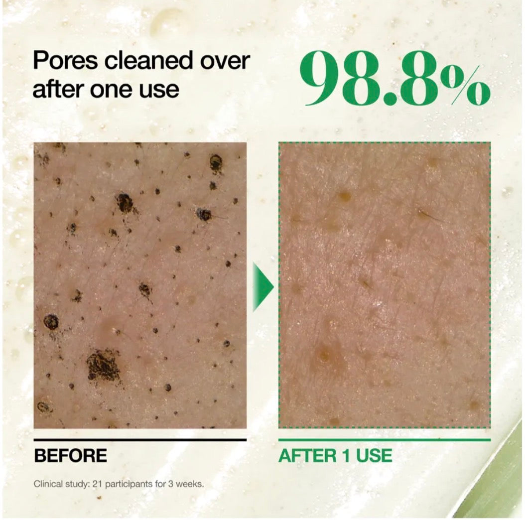 ANUA Heartleaf + BHA Pore Deep Cleansing Foam | 150ml