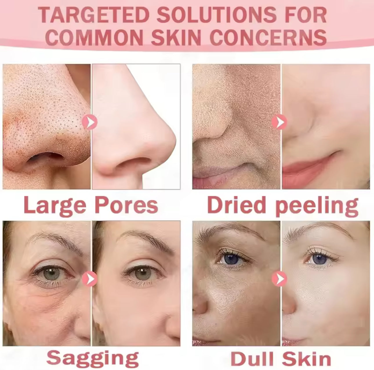 Dr Meinaier Alpha Arbutin Body Serum AHA Body Serum Niacinamide Whitening Essence 500ml | 💯 Authentic from Thailand 🇹🇭