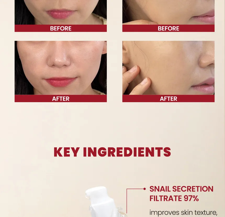 SEOUL 1988 Essence : Snail Mucin 97% + Rice KSECRET 100ml