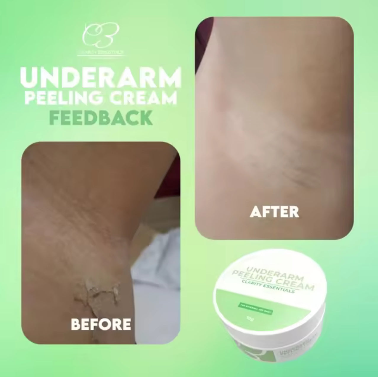 UNDERARM PEELING CREAM | Clarity Essentials 10g
