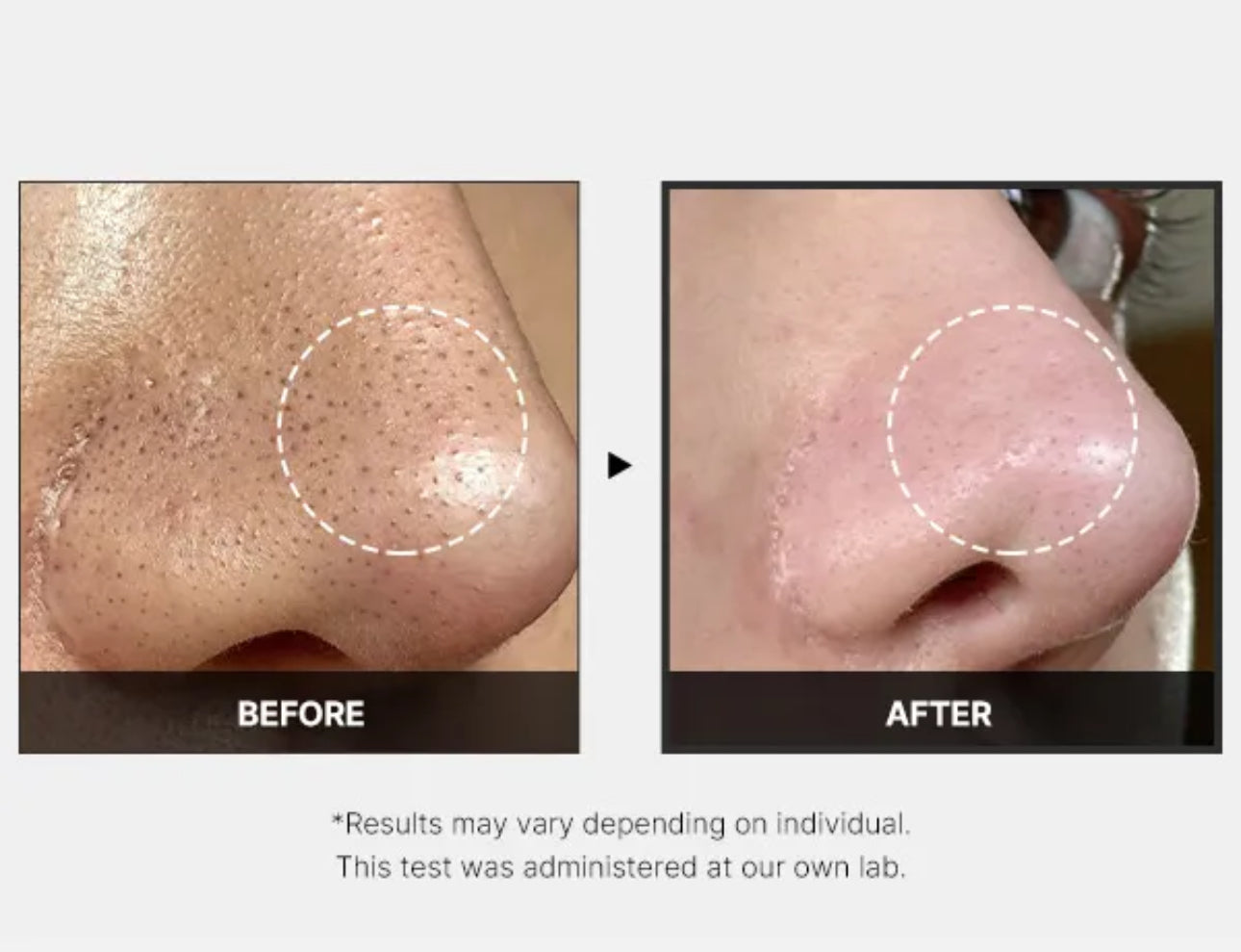 Medicube One Day Exosome Shot 7500 | 30ml