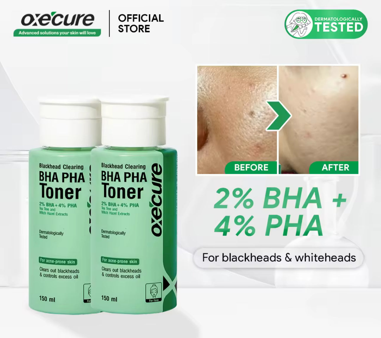 Oxecure Blackhead Clearing BHA PHA Toner | 150ml