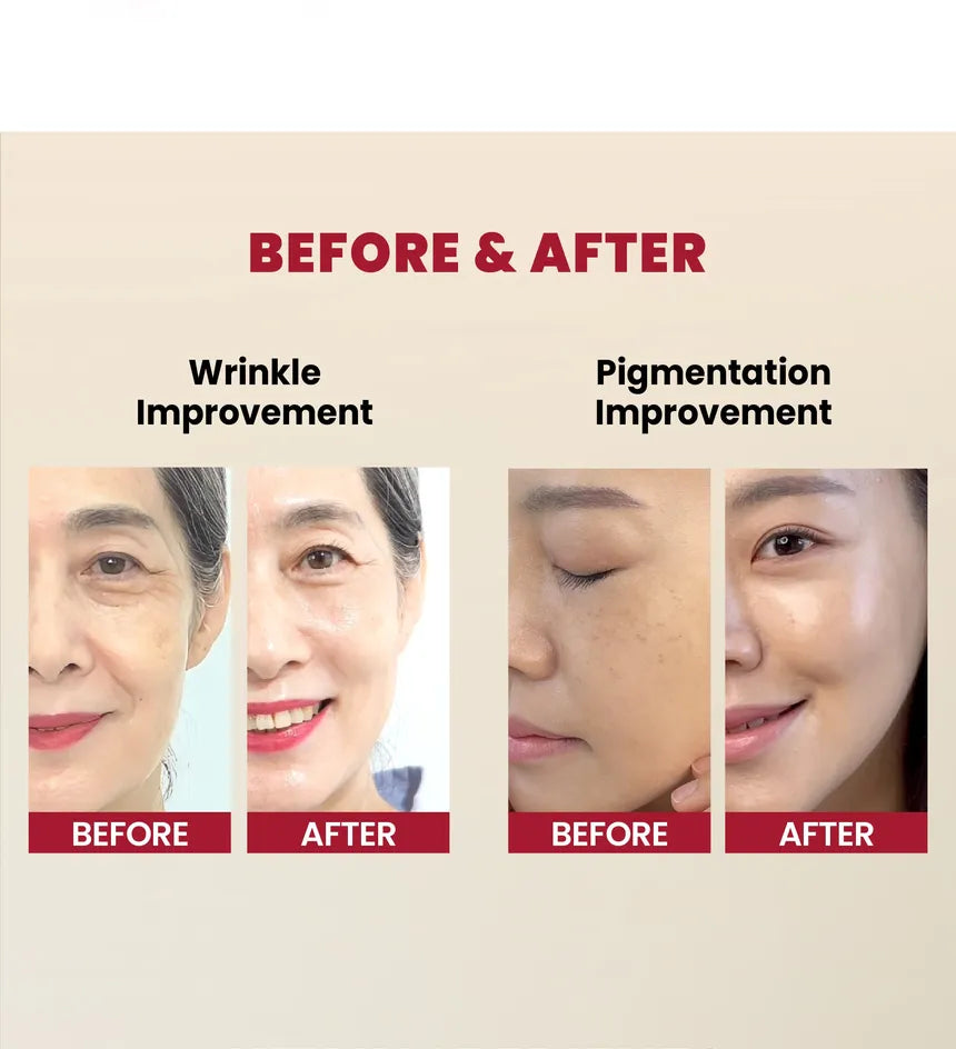 SEOUL 1988 Serum : Retinal Liposome 2% + Black Ginseng 30ml KSECRET