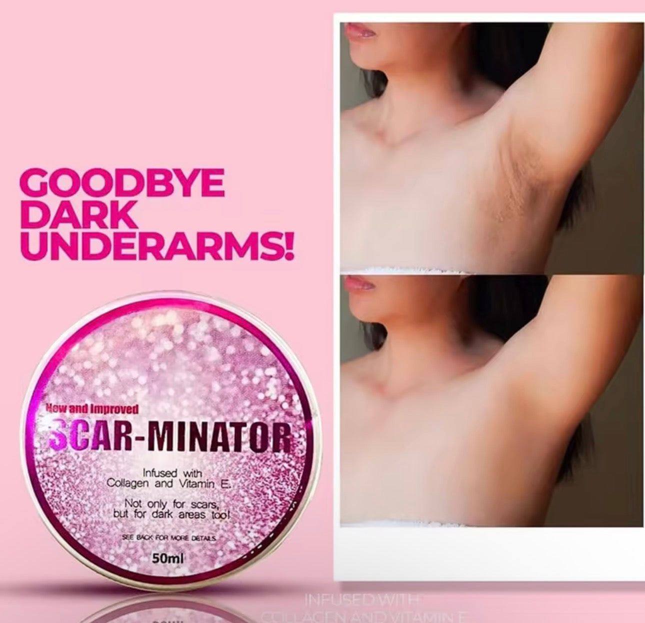 Scar-Minator Cream 50ml