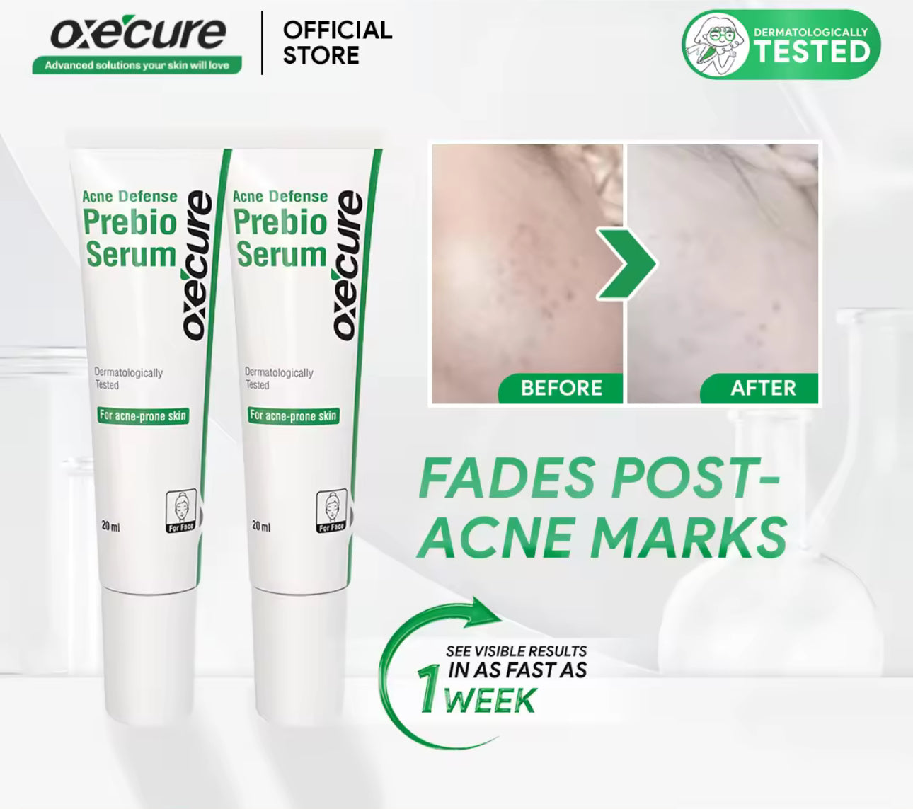 Oxecure Acne Defense Prebio Serum | 20ml