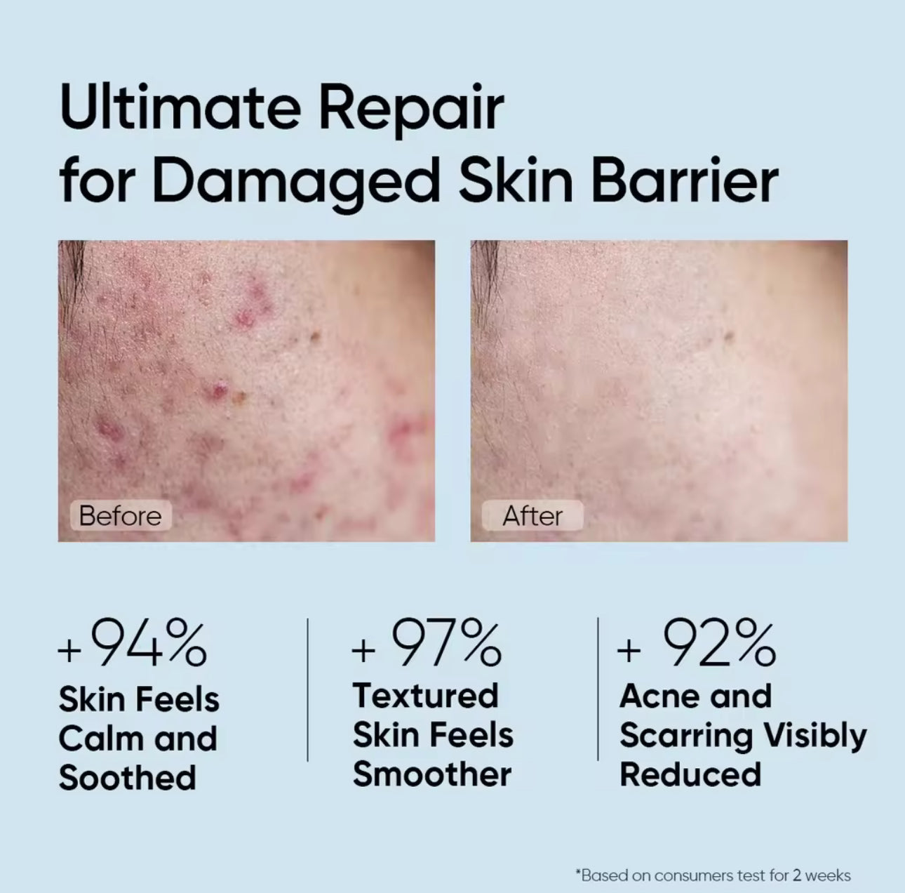 SKINTIFIC 5X Ceramide Skin Barrier Repair Serum Scientific Power Repairing Essence Facial Skin Serum |Bigger size 50ml