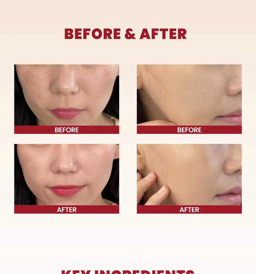 SEOUL 1988 Cream : Snail Mucin 93% + Rice KSECRET 100ml