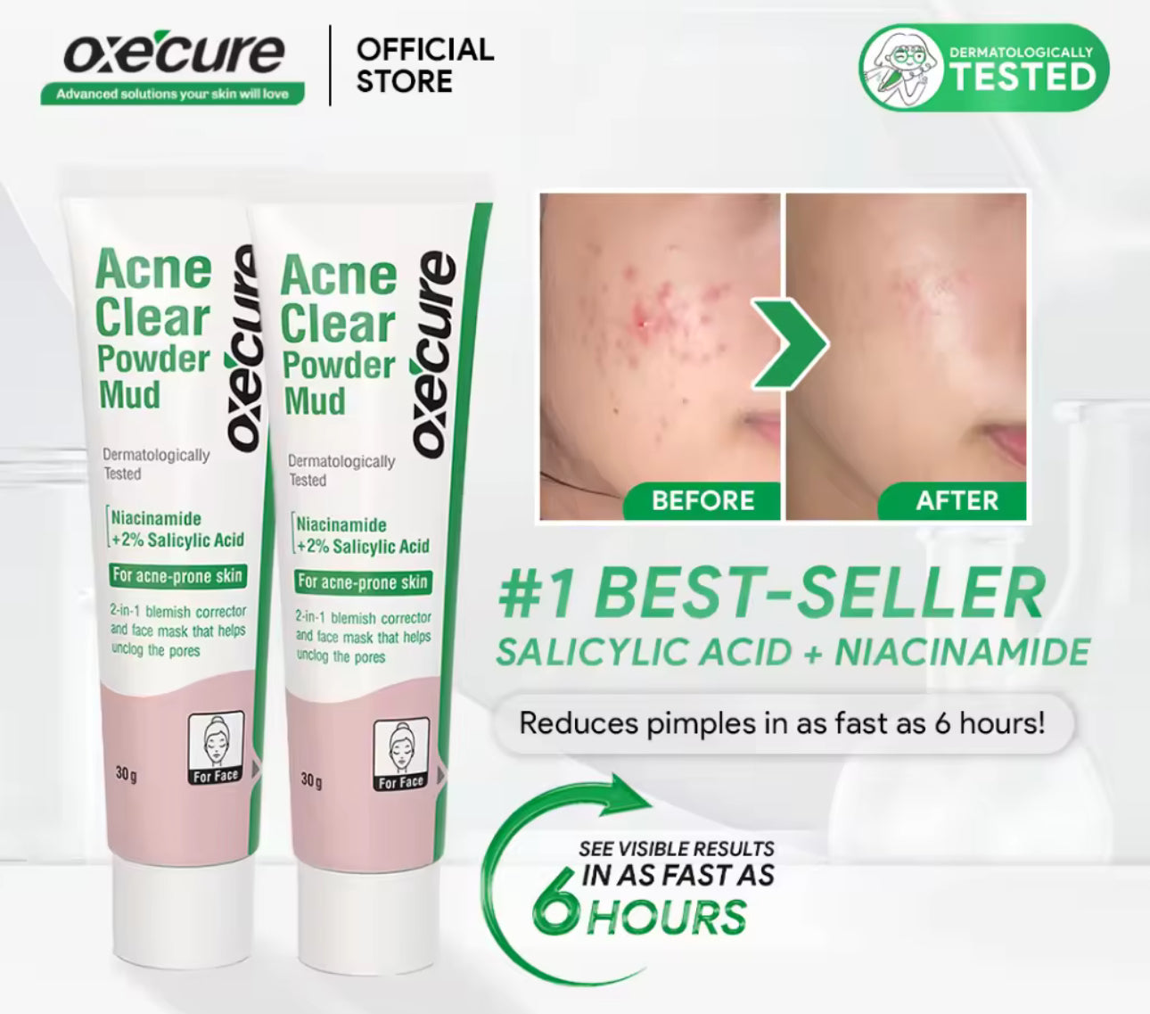 Oxecure Acne Clear Powder Mud | 30g