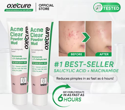 Oxecure Acne Clear Powder Mud | 30g
