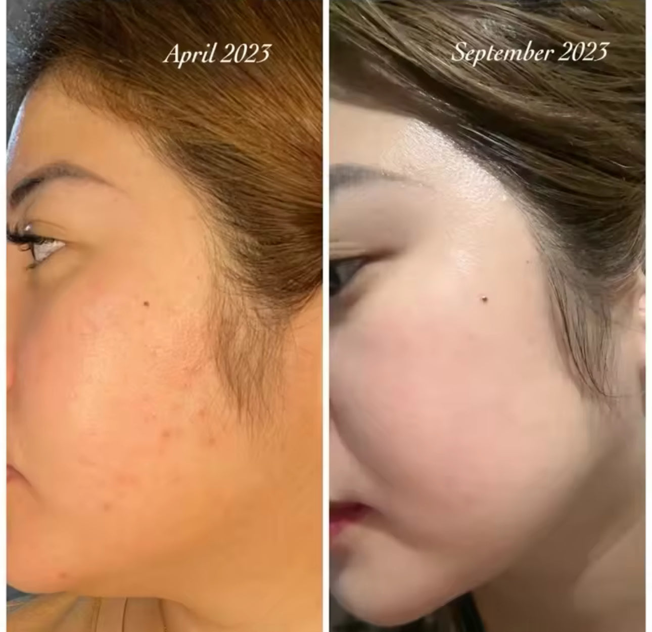 Her Choice Ph Centella Asiatica Premium Repair Set