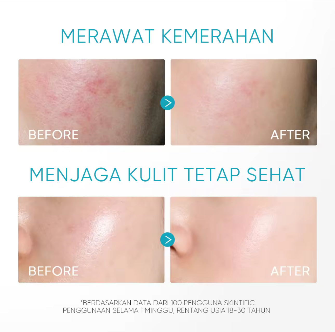 SKINTIFIC 5% PANTHENOL ACNE CALMING WATER GEL (45g)