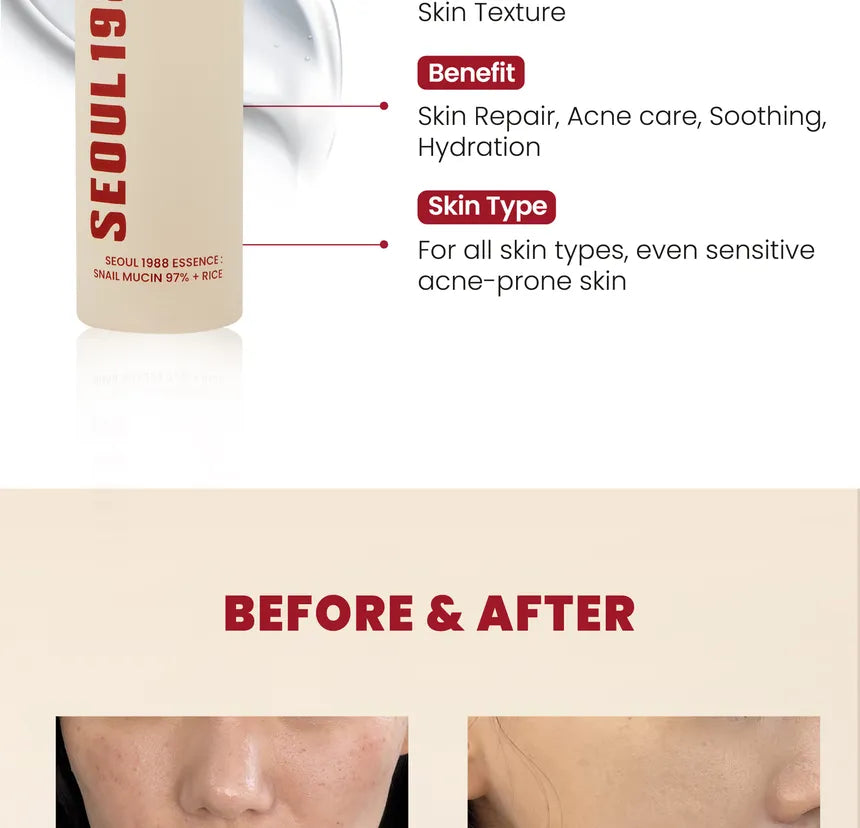 SEOUL 1988 Essence : Snail Mucin 97% + Rice KSECRET 100ml