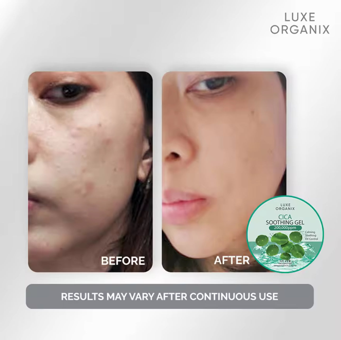 LUXE ORGANIX Cica Soothing Gel 300ml