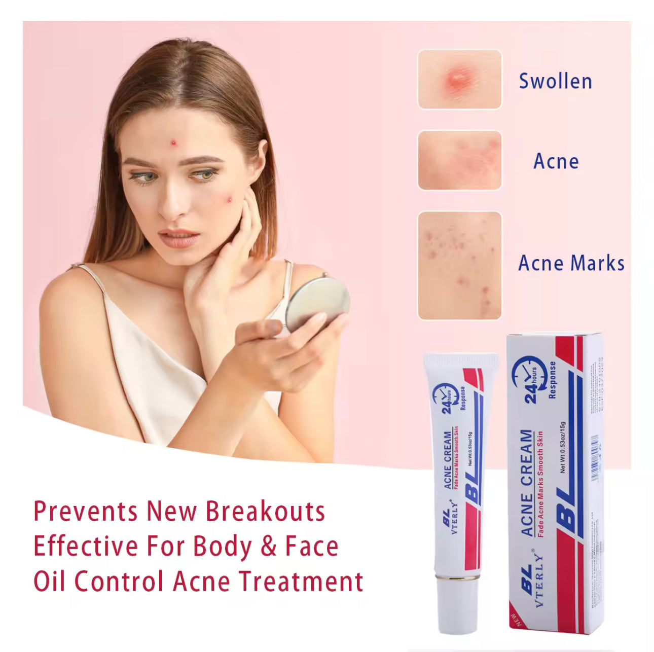 BL VTERLY Acne Cream | 20g