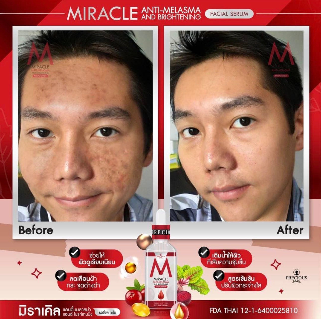 Miracle Anti-Melasma & Brightening Facial Serum | 50ml