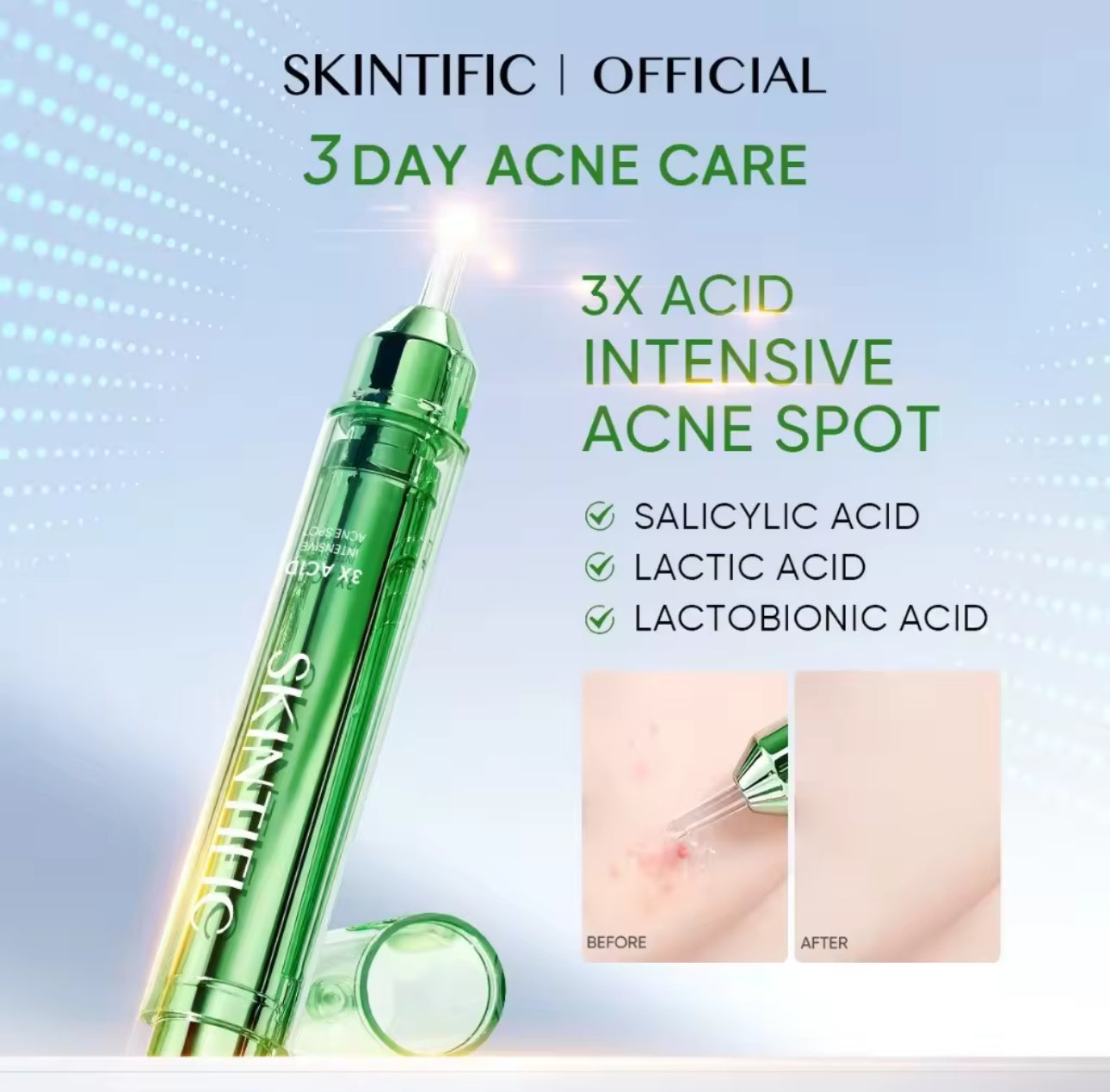 SKINTIFIC 3X ACID ANTI ACNE SPOT (11g)