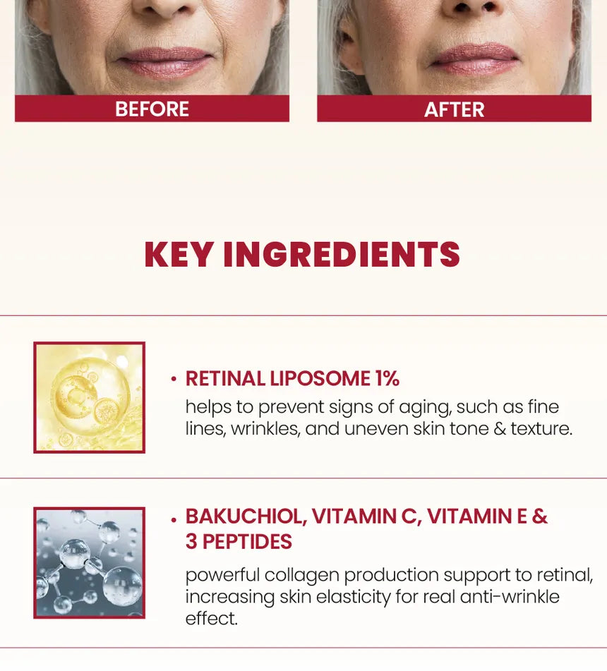 SEOUL 1988 Cream : Retinal Liposome 1% + Fermented Rice - KSECRET