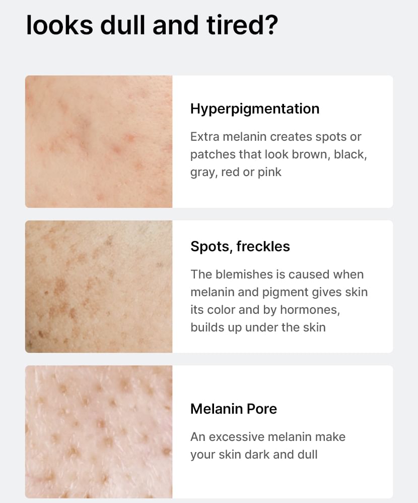 celimax - Pore + Dark Spot Brightening Serum 30ml