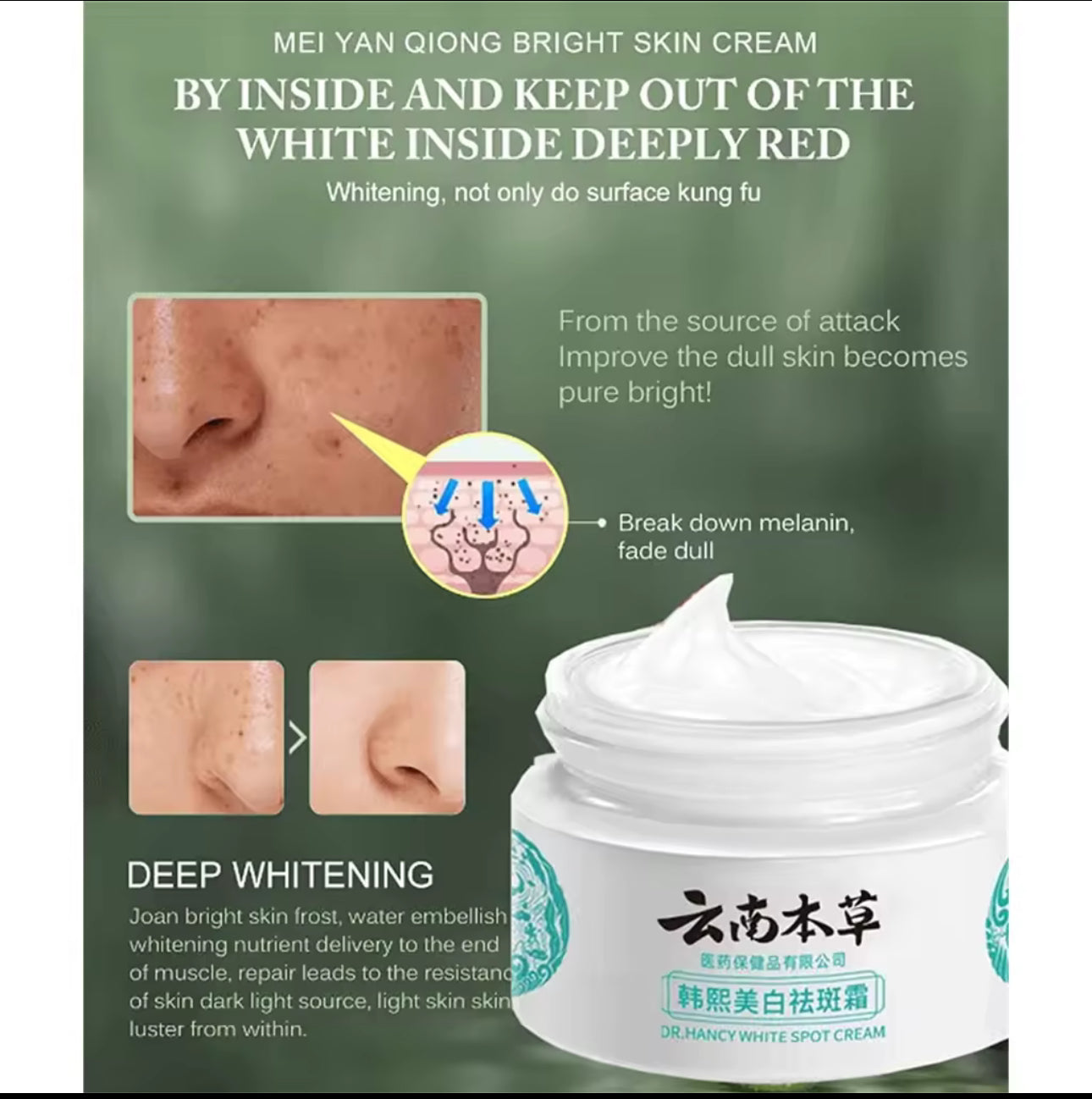 JAPAN Melasma Cream White Spot Cream Skin Care Face Moisturizer Freckle Whitening Cream 20g
