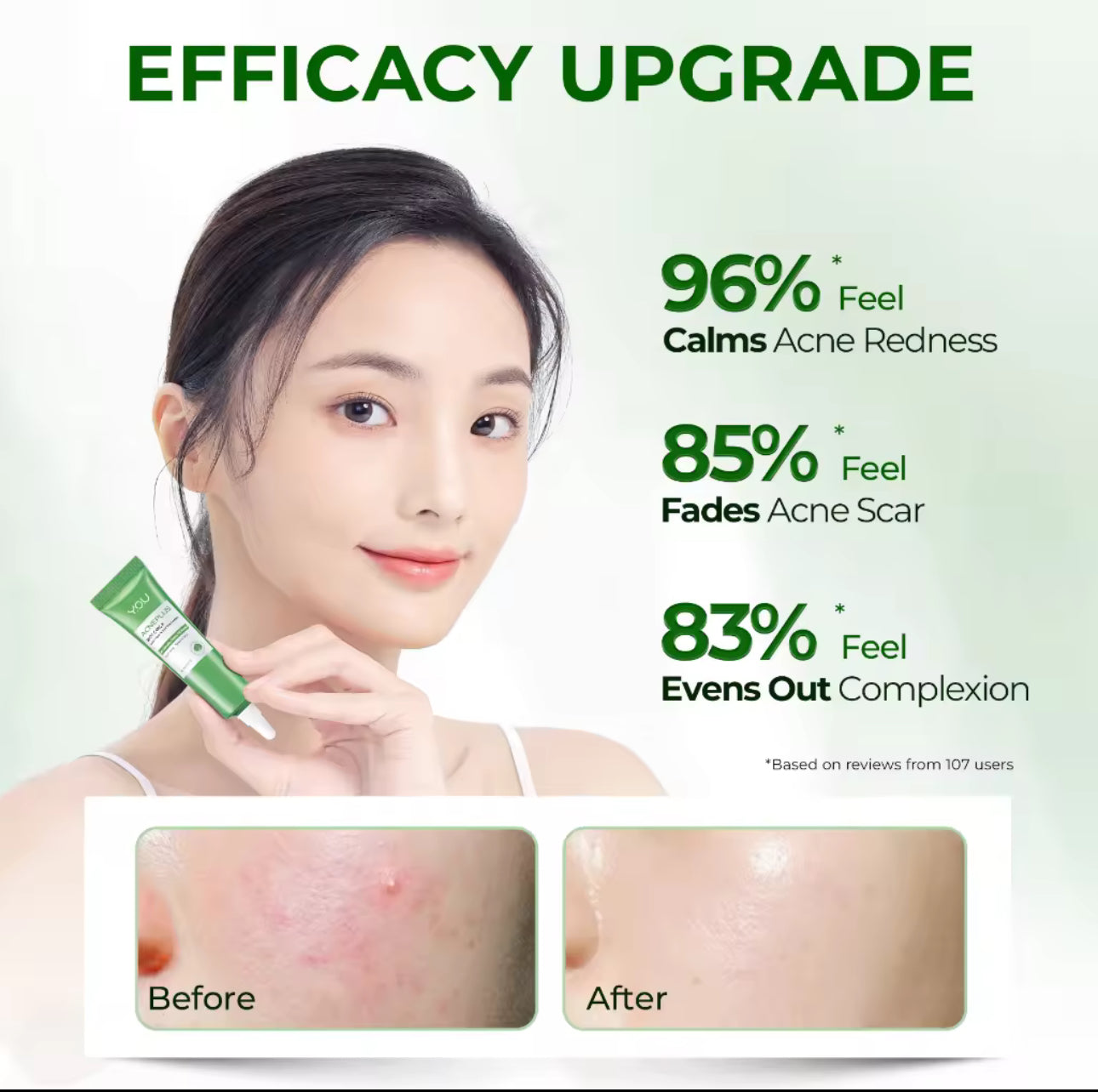 Y.O.U AcnePlus Triple Action Spot Care X | Acne Treatment | Calm Redness | Acne Scar Remover 15g