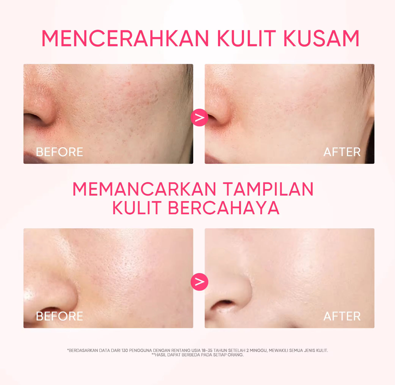 SKINTIFIC Niacinamide Brightening Essence Toner Hydrate Moisturize Skincare