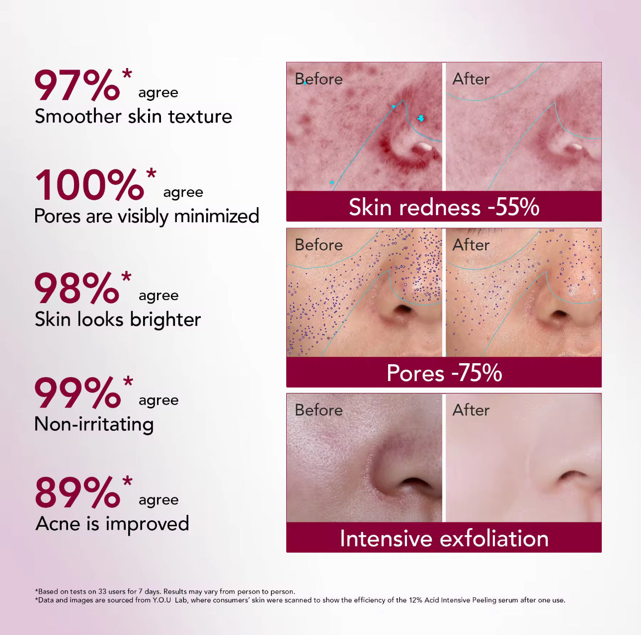 Y.O.U Reeffect Boost 12% Acid Intensive Peeling Serum 30ml l 12% AHA+BHA+PHA