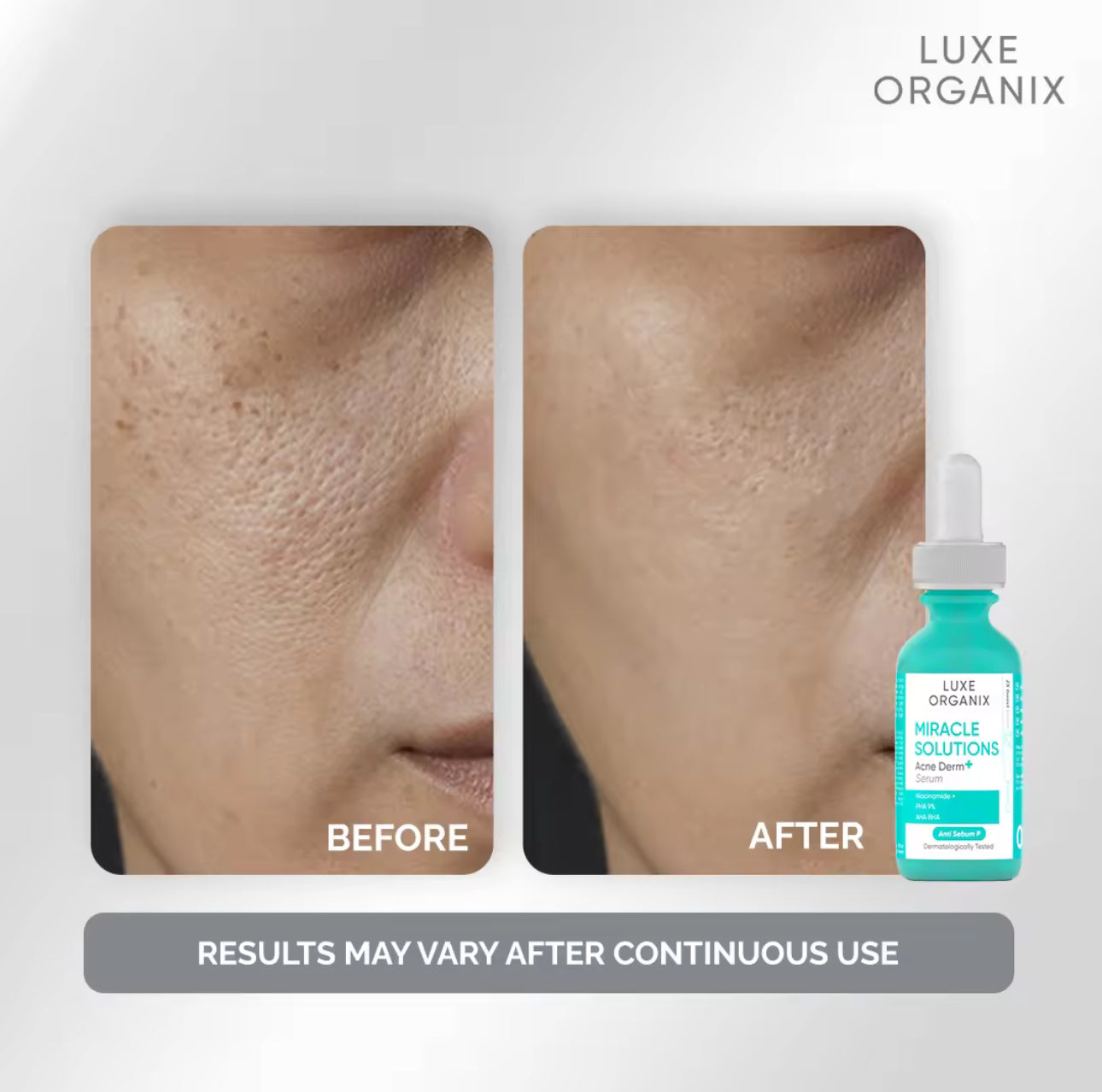 LUXE ORGANIX Miracle Solutions AHA BHA Serum 30ml