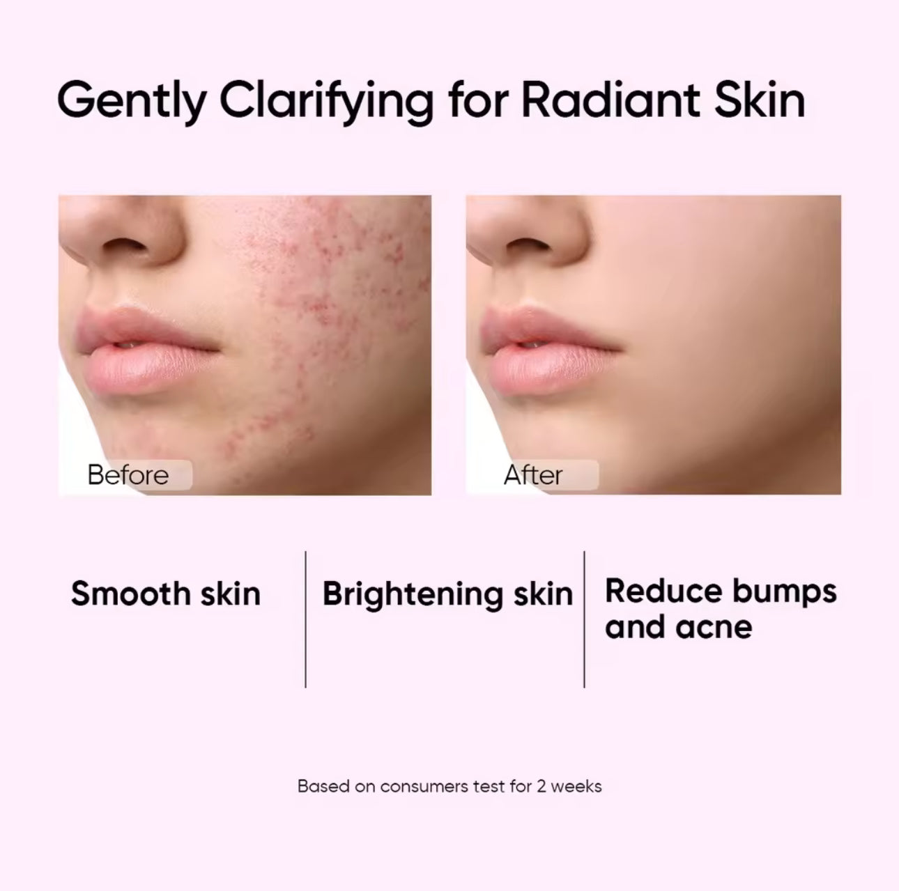SKINTIFIC Glycolic Acid Daily Clarifying Toner | 80ml | Daily Exfoliating Brighten Skin With Niacinamide