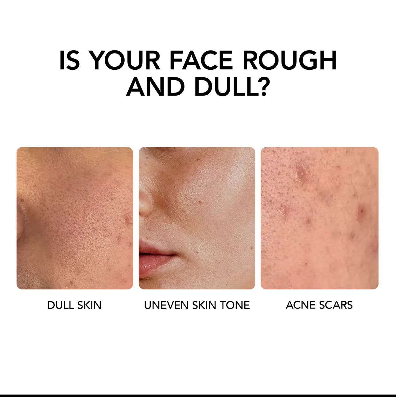 Y.O.U Hy! Amino Glowing Acne Calming Deep Cleanser l Radiant Skin and Acne Calming l 100ml