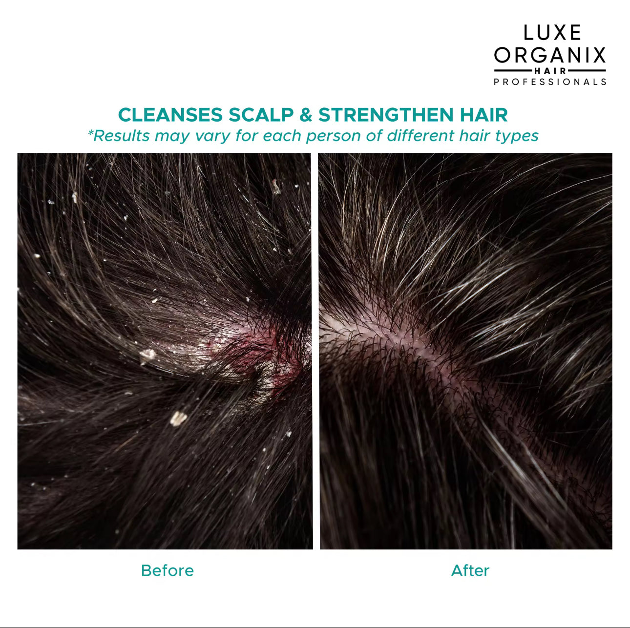 Luxe Organix Scalp Therapy Anti-Hair Fall  Gentle Clarifying Detox Shampoo 270ml