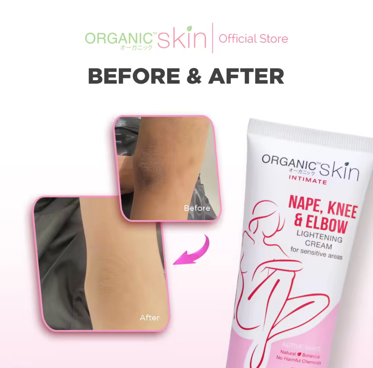 Organic Skin Japan Nape, Knee & Elbow Lightening Cream 50ml Whitening cream
