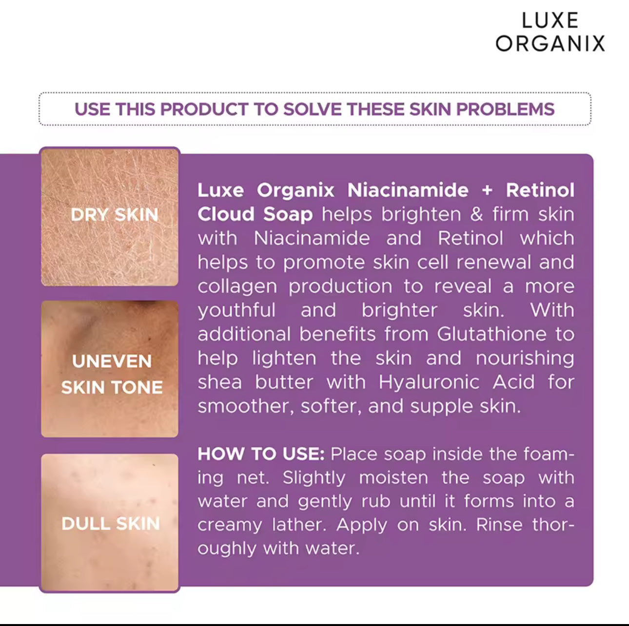 LUXE ORGANIX Niacinamide + Retinol Cloud Soap 180g
