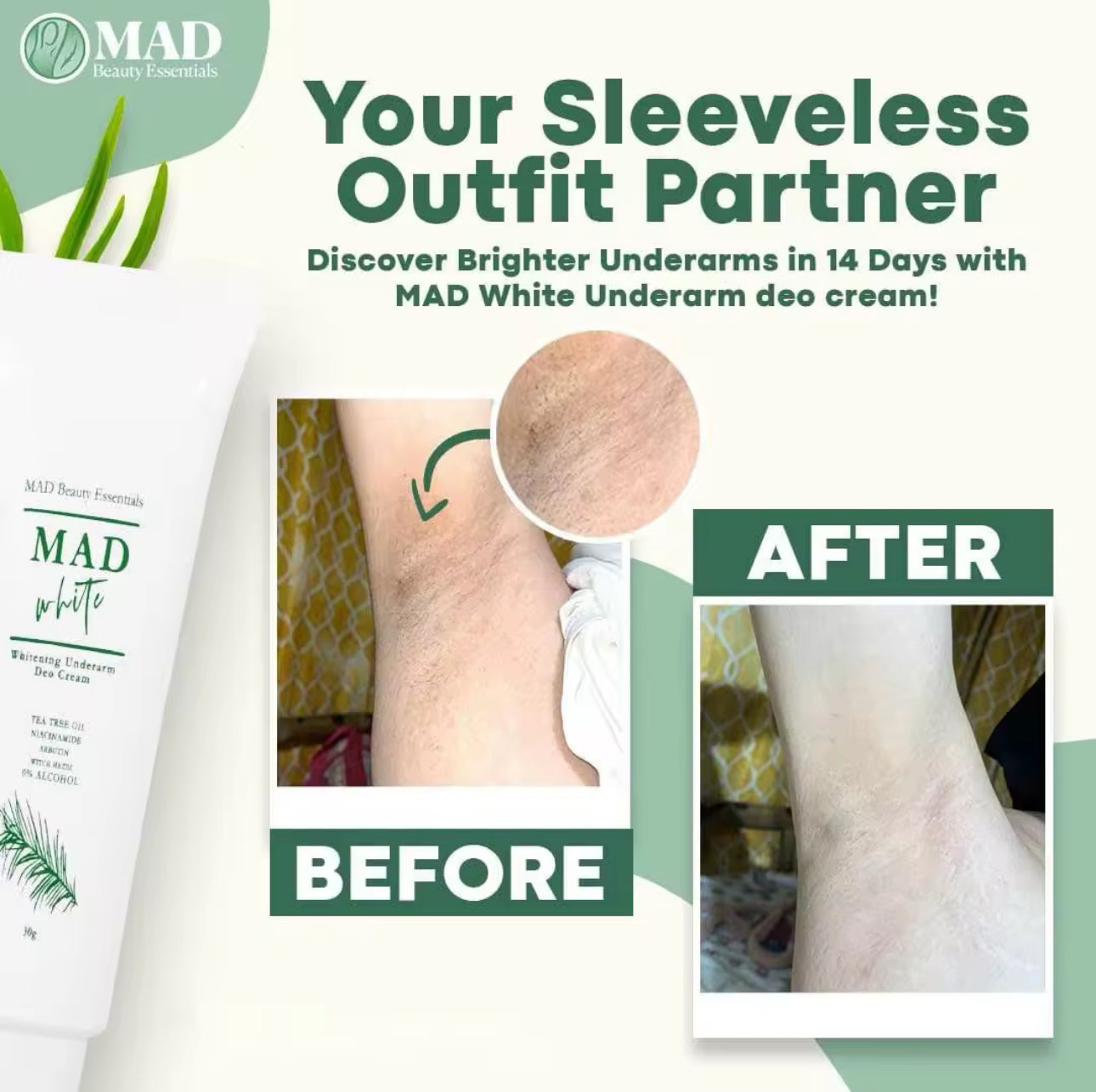 MAD White Underarm Whitening Deo Cream