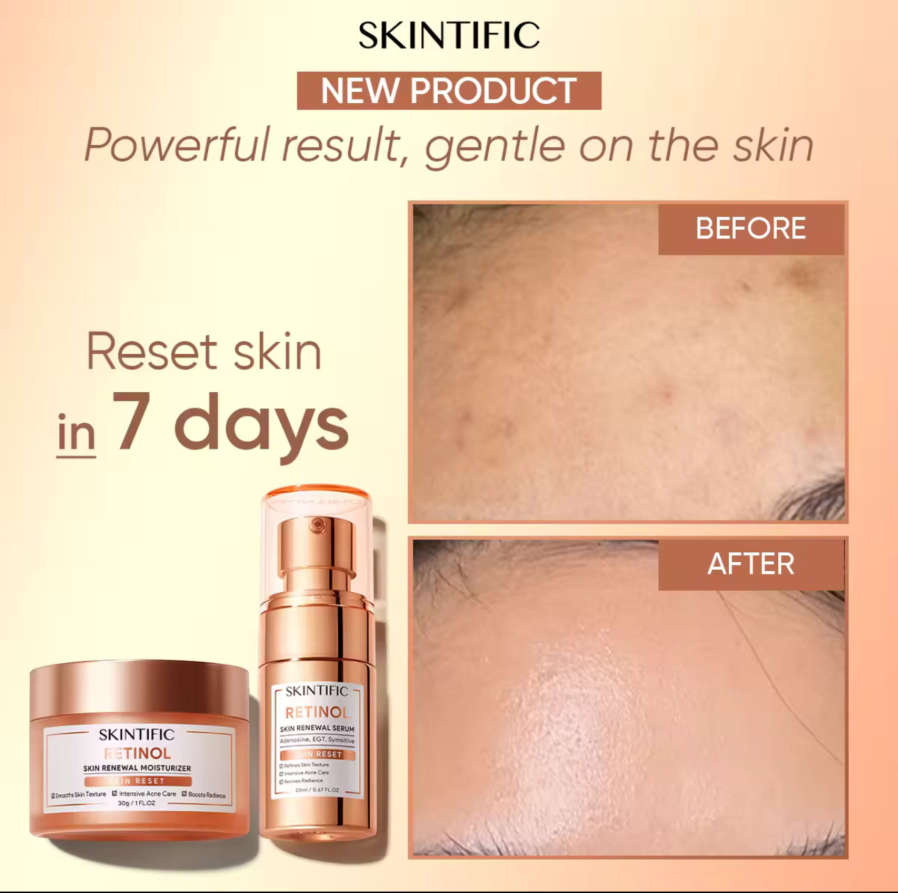 SKINTIFIC Retinol Skin Renewal Moisturizer 30g