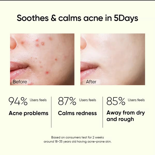 SKINTIFIC Salicylic Acid Anti Acne Serum (20ml)