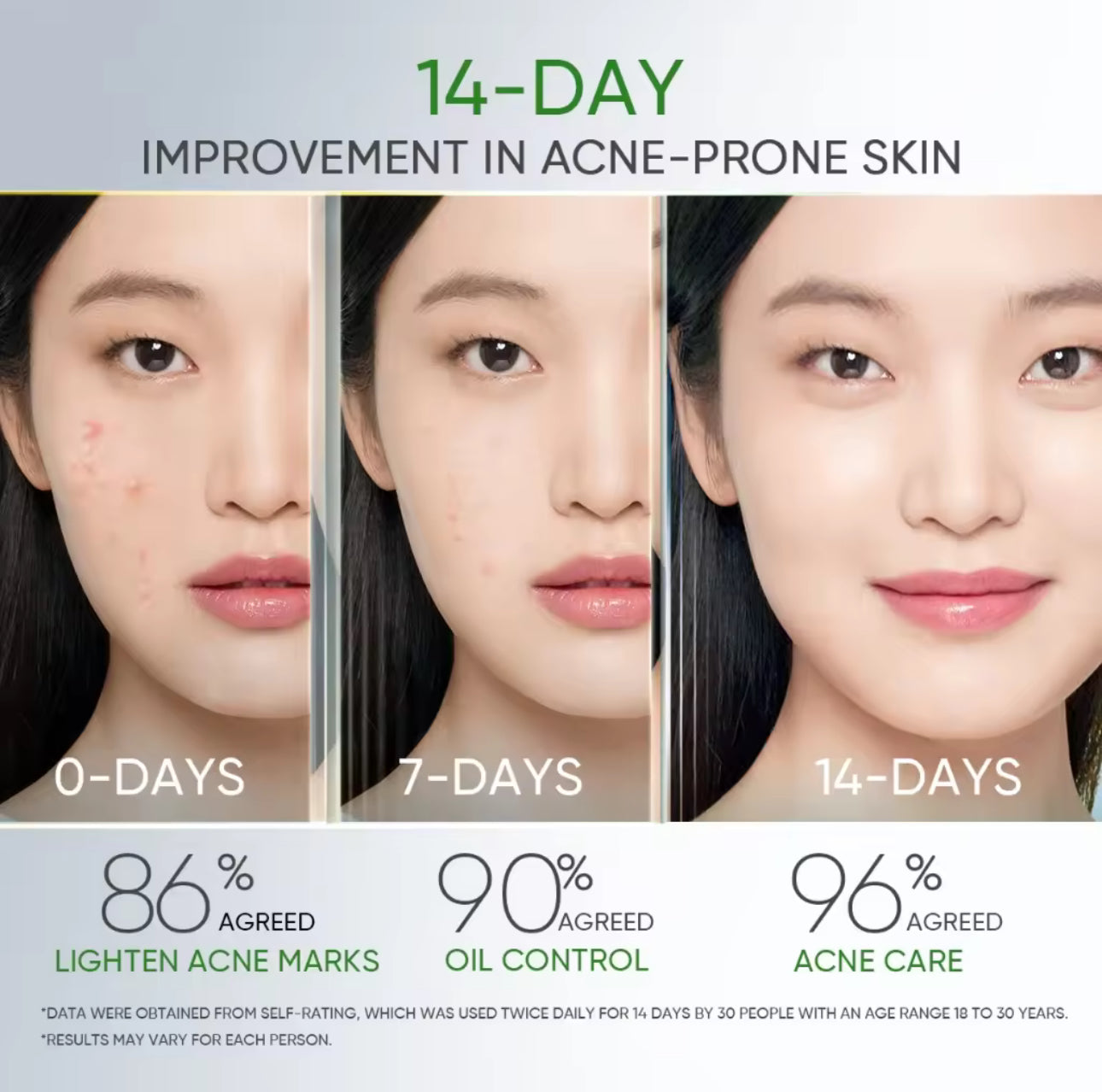 SKINTIFIC 3X ACID ANTI-ACNE Gel Moisturizer Acne Cream moisturiser 30g with Salicylic Acid
